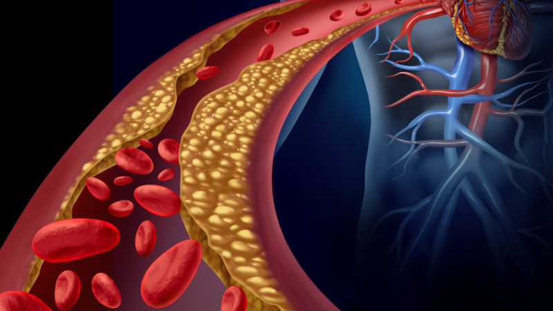 What causes coronary illness? Who’s most in danger and treatment