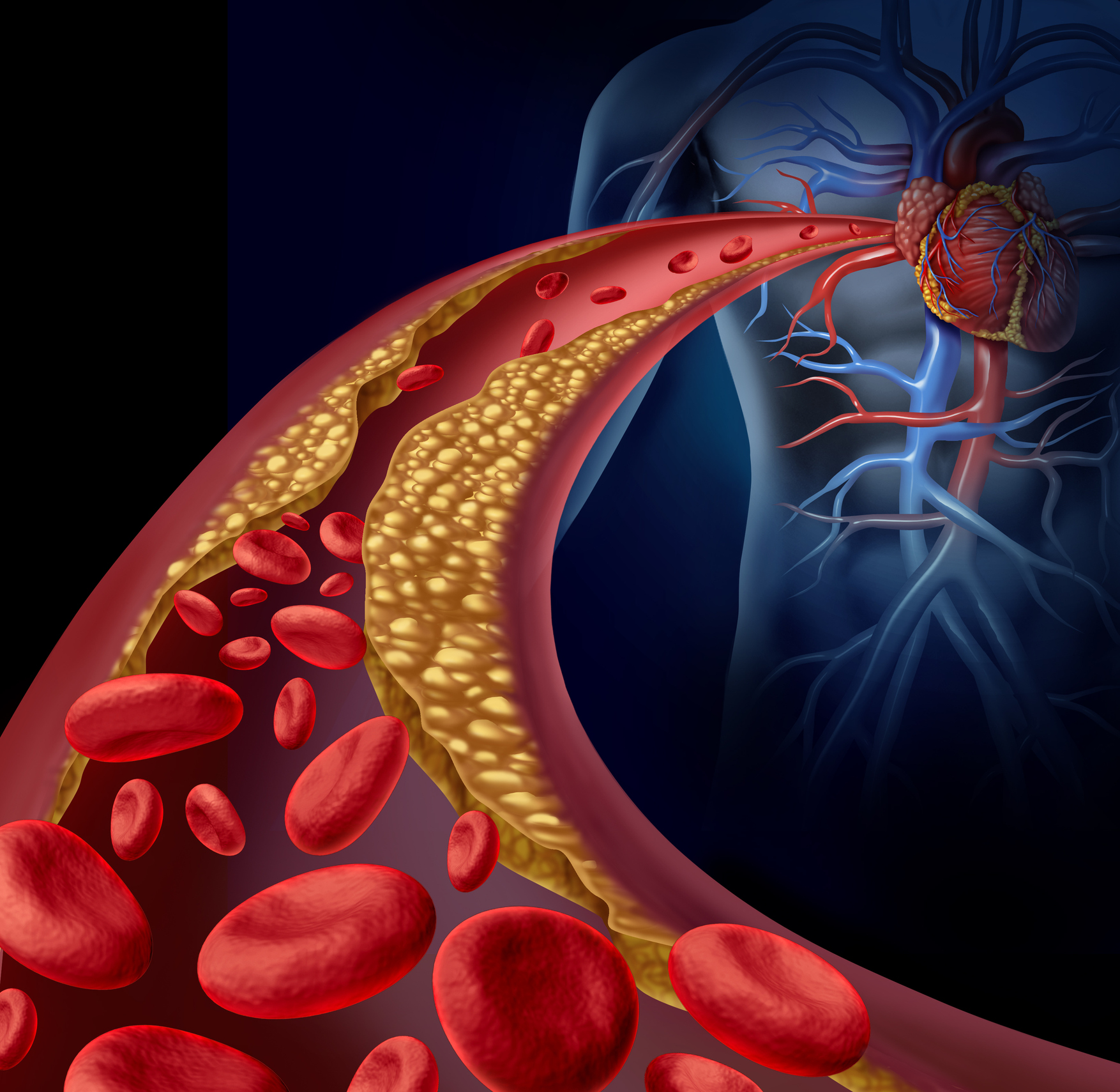 What causes coronary illness? Who’s most in danger and treatment
