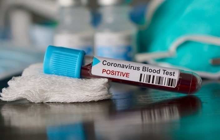 In the midst of coronavirus concerns L.A. Region training office tells wants that all schools close